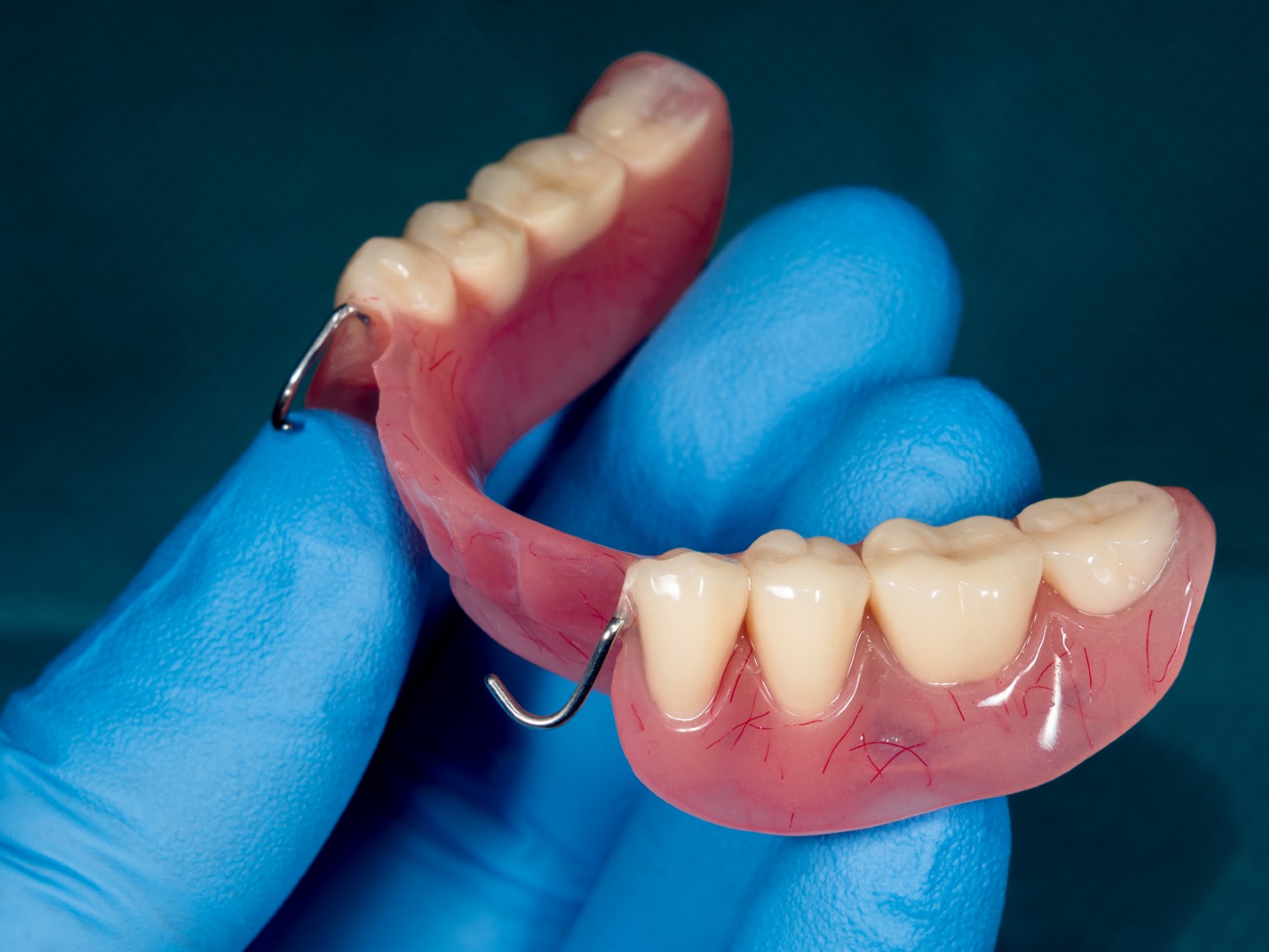 Partial Dentures (1)